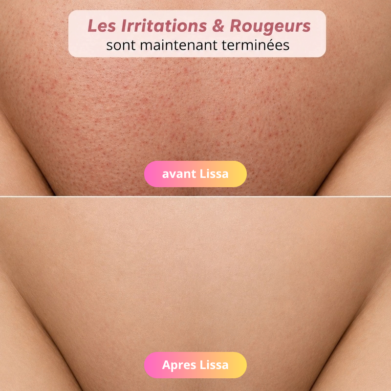 rasoir Lissa